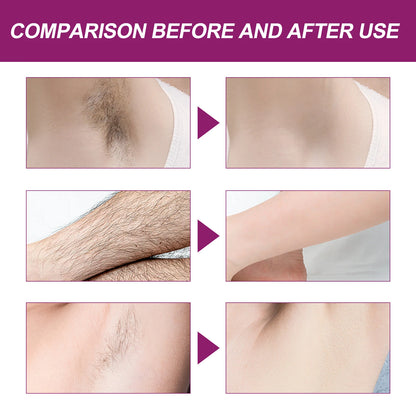 Oceaura Hair Removal Spray Painless Quick Smoothing Skin Silky Beauty Body Delay Growth Hair Removal Mist for Armpit Leg Bikini