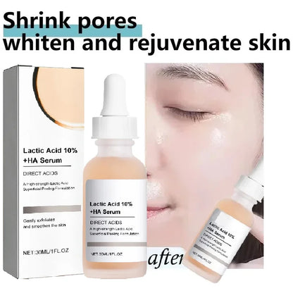 Large Pore essence Lactic Acid Facial Pore Shrinking Product Pore Firming and Smooth Korean Skin Care