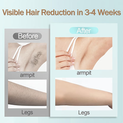 IPL Hair Removal Device, Suitable For Women And Men. IPL Device For Hair Removal, Almost Painless And With Lasting Effects. 9 Modes And Automatic Flashing. For Quick Full-body Hair Removal At Home. The Perfect Gift For New Ye
